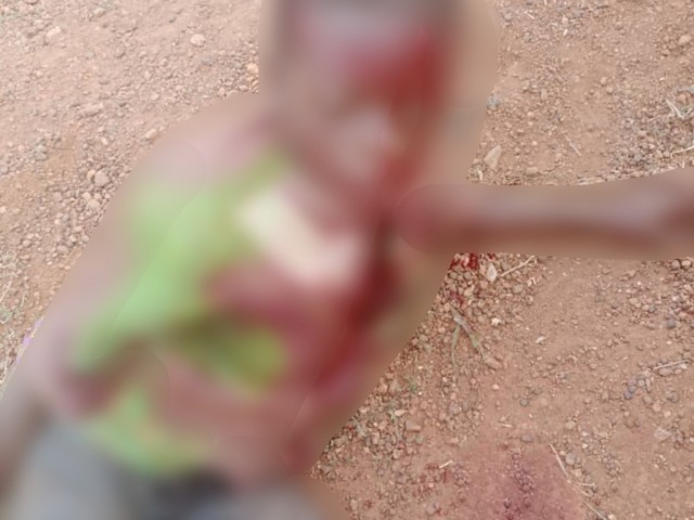UN VEHICULE DE TRANSPORT PERCUTE 02 ENFANTS A ABENGOUROU